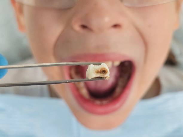 Best Emergency TMJ Treatment in Park Falls, WI